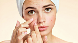 acne-treatment